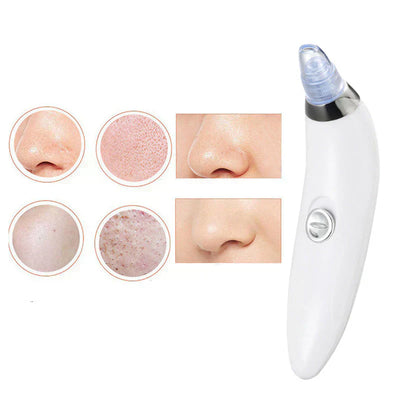 4 in 1 Derma Blackhead Remover Machine