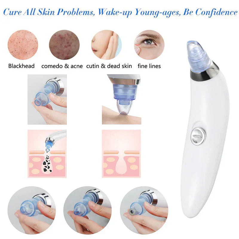 4 in 1 Derma Blackhead Remover Machine