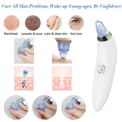 4 in 1 Derma Blackhead Remover Machine